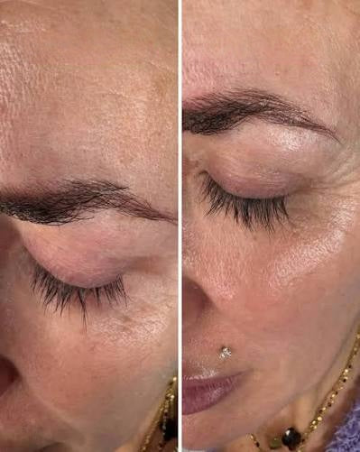 Anne, 46